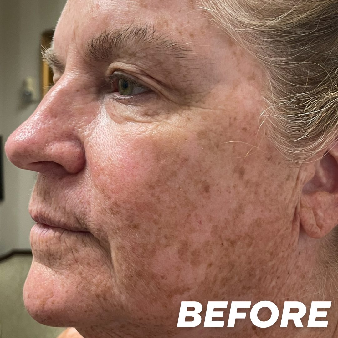 Gail before treatment