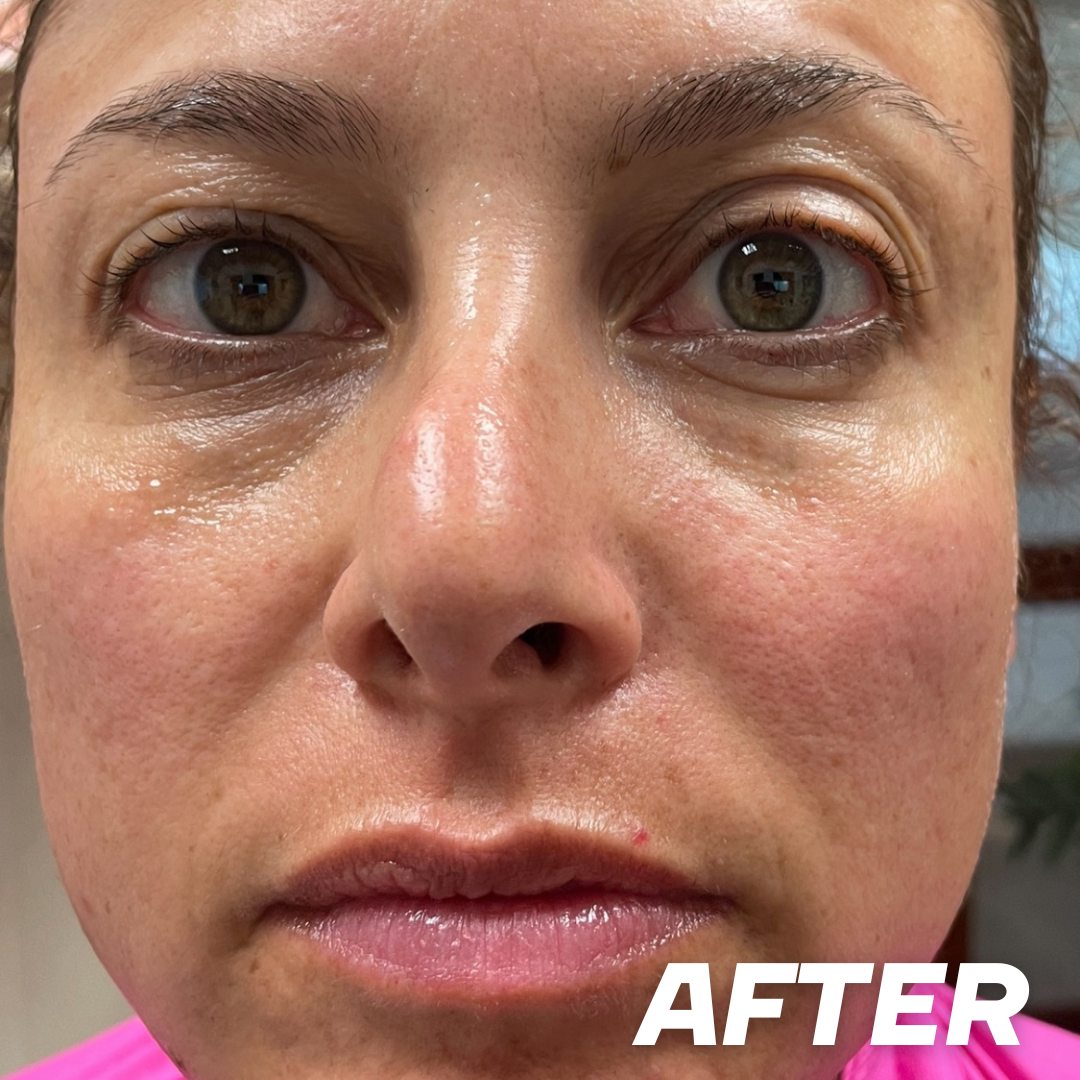 Jenny after treatment