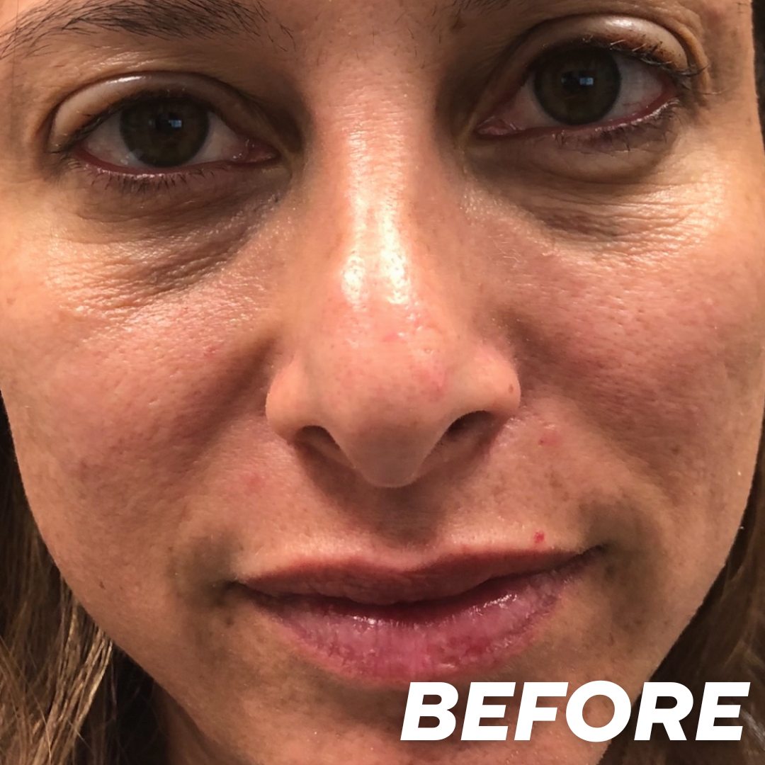 Jenny before treatment