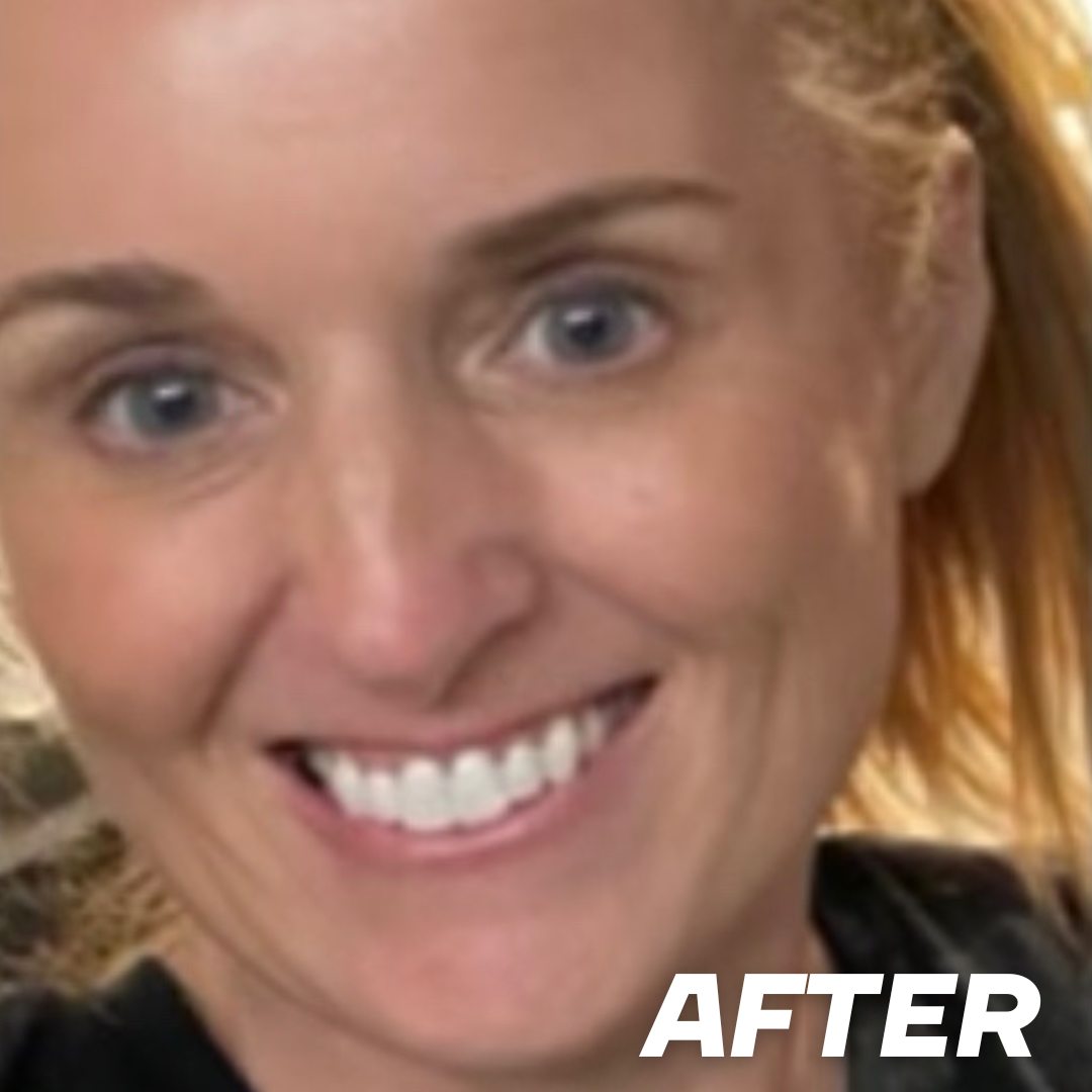 Molly after treatment