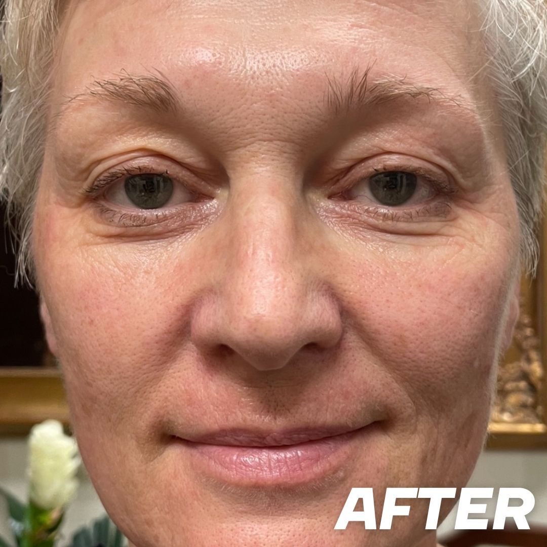 Client result I before treatment