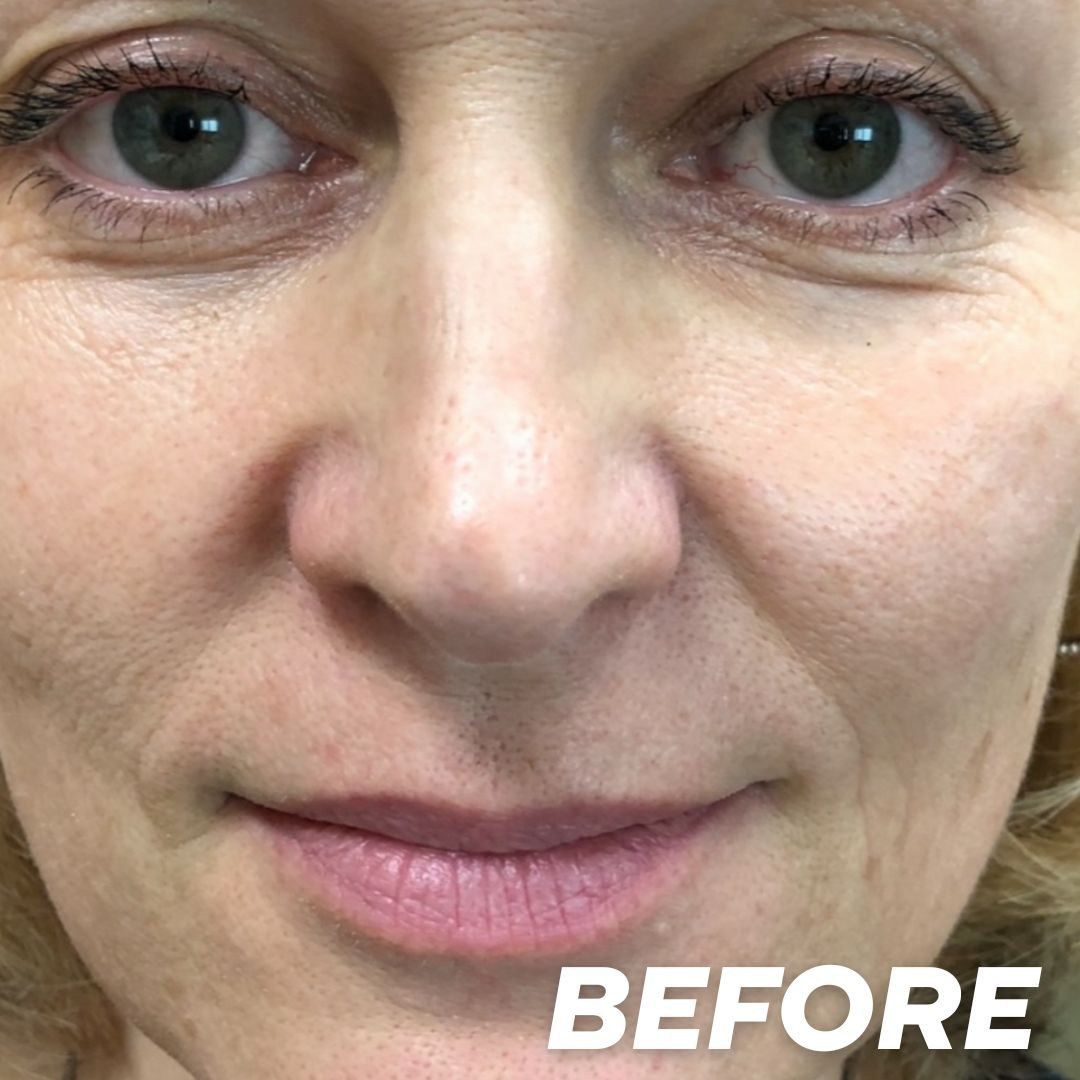 Client result I after treatment