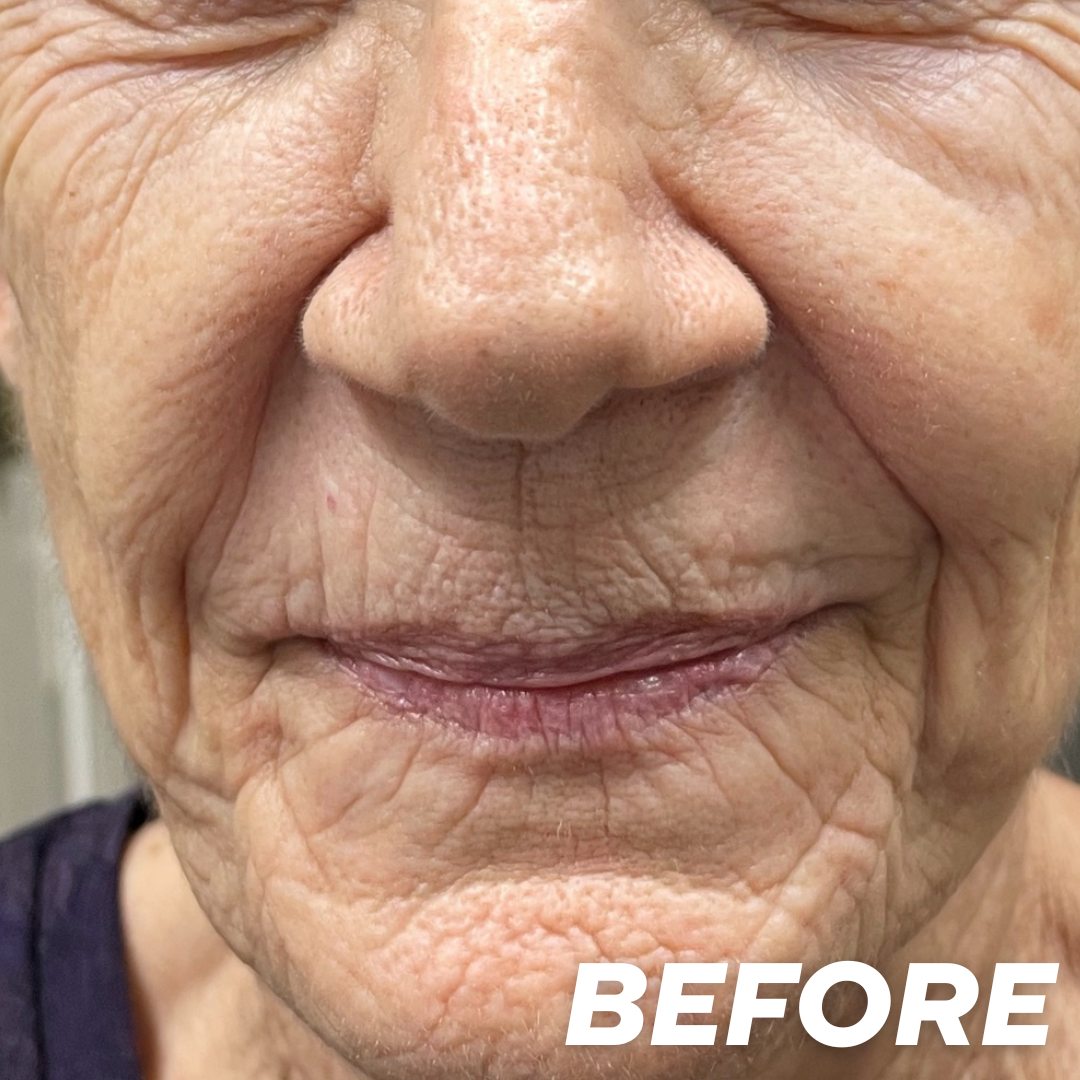 Vita before treatment